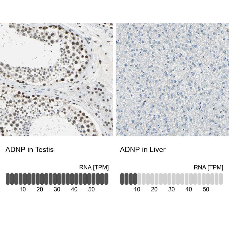 Anti-ADNP Antibody