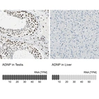 Anti-ADNP Antibody