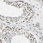 Immunohistochemical staining of human testis shows moderate to strong nuclear positivity in cells in seminiferous ducts.