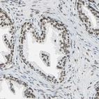 Immunohistochemical staining of human prostate shows strong nuclear positivity in glandular cells.
