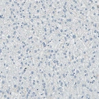 Immunohistochemical staining of human liver shows no positivity in hepatocytes as expected.