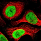 Immunofluorescent staining of human cell line U-2 OS shows localization to nucleoplasm.