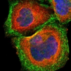 Immunofluorescent staining of human cell line A-431 shows localization to plasma membrane & actin filaments.
