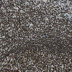 Immunohistochemical staining of human tonsil shows strong nuclear positivity in non-germinal center cells.