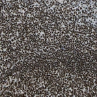 Immunohistochemical staining of human tonsil shows strong nuclear positivity in non-germinal center cells.