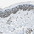 Immunohistochemical staining of human skin shows strong nuclear positivity in squamous epithelial cells.