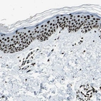 Immunohistochemical staining of human skin shows strong nuclear positivity in squamous epithelial cells.