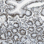 Immunohistochemical staining of human small intestine shows moderate nuclear positivity in glandular cells.