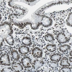 Immunohistochemical staining of human small intestine shows moderate nuclear positivity in glandular cells.
