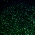 Immunofluorescence staining of mouse basal forebrain shows moderate nuclear positivity in neurons in the caudate putamen.