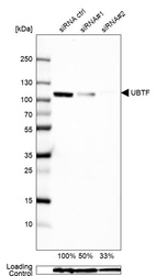 Western blot analysis in U2OS cells transfected with control siRNA, target specific siRNA probe #1 and #2, using Anti-UBTF antibody. Remaining relative intensity is presented. Loading control: Anti-GAPDH.