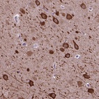 Anti-PIAS3 Antibody