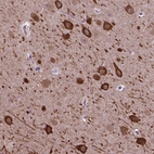 Anti-PIAS3 Antibody