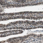 Immunohistochemical staining of human fallopian tube shows strong nuclear positivity in glandular cells.