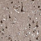Immunohistochemical staining of human cerebral cortex shows strong nuclear and cytoplasmic positivity in neurons.