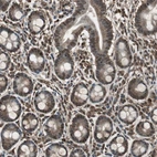 Immunohistochemical staining of human duodenum shows strong nuclear positivity in glandular cells.