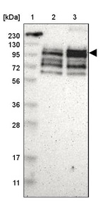 Anti-PPP1R13B Antibody