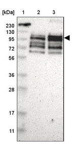 Lane 1: Marker [kDa] 230, 130, 95, 72, 56, 36, 28, 17, 11_br/_Lane 2: Human cell line RT-4_br/_Lane 3: Human cell line U-251MG sp