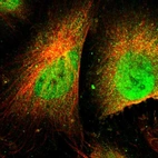 Immunofluorescent staining of human cell line U-251 MG shows localization to nucleoplasm & cytosol.