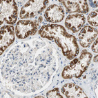 Immunohistochemical staining of human kidney shows strong granular cytoplasmic positivity in cells in tubules.