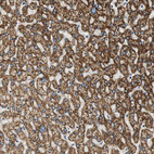 Immunohistochemical staining of human liver shows strong granular cytoplasmic positivity in hepatocytes.