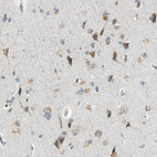 Immunohistochemical staining of human cerebral cortex shows moderate granular cytoplasmic positivity in neurons.