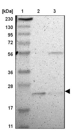 Lane 1: Marker [kDa] 230, 130, 95, 72, 56, 36, 28, 17, 11_br/_Lane 2: Human cell line RT-4_br/_Lane 3: Human cell line U-251MG sp