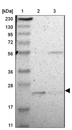 Lane 1: Marker [kDa] 230, 130, 95, 72, 56, 36, 28, 17, 11_br/_Lane 2: Human cell line RT-4_br/_Lane 3: Human cell line U-251MG sp
