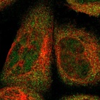 Immunofluorescent staining of human cell line A-431 shows localization to nucleoplasm & cytosol.