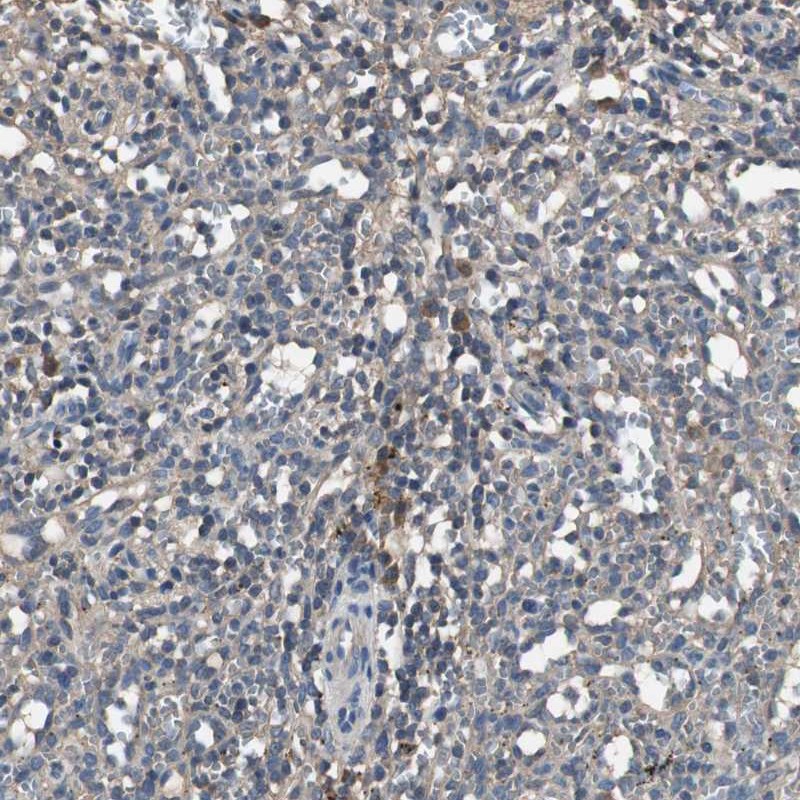 Anti-TNFRSF14 Antibody