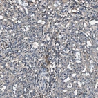 Anti-TNFRSF14 Antibody