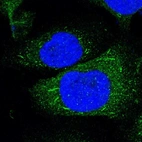 Immunofluorescent staining of human cell line U-2 OS shows localization to cytosol & rods & rings.