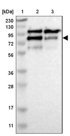 Lane 1: Marker [kDa] 230, 130, 95, 72, 56, 36, 28, 17, 11_br/_Lane 2: Human cell line RT-4_br/_Lane 3: Human cell line U-251MG sp
