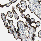 Immunohistochemical staining of human placenta shows moderate to strong cytoplasmic positivity in trophoblastic cells.