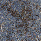Immunohistochemical staining of human lymph node shows moderate cytoplasmic positivity.