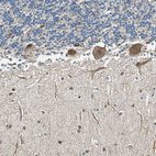 Immunohistochemical staining of human cerebellum shows moderate cytoplasmic positivity in purkinje cells.