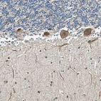 Immunohistochemical staining of human cerebellum shows moderate cytoplasmic positivity in purkinje cells.