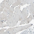 Immunohistochemical staining of human skeletal muscle shows very weak positivity.
