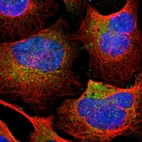 Immunofluorescent staining of human cell line U-2 OS shows localization to cytosol.