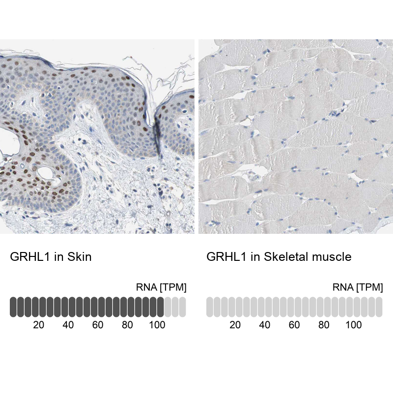 Anti-GRHL1 Antibody