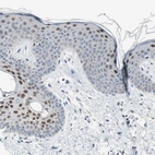 Immunohistochemical staining of human skin shows moderate to strong nuclear positivity in squamous epithelial cells.