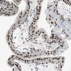 Immunohistochemical staining of human placenta shows strong nuclear positivity in trophoblastic cells.