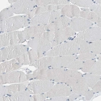 Immunohistochemical staining of human skeletal muscle shows no positivity in myocytes as expected.