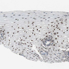 Immunohistochemical staining of human esophagus shows moderate to strong nuclear positivity in squamous epithelial cells.