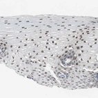 Immunohistochemical staining of human esophagus shows moderate to strong nuclear positivity in squamous epithelial cells.