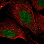 Immunofluorescent staining of human cell line U-2 OS shows localization to nucleoplasm & vesicles.