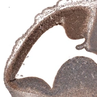 Immunohistochemical staining of mouse embryo E11 shows moderate nuclear positivity in neuronal cells in developing cortex.