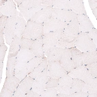 Immunohistochemical staining of human skeletal muscle shows no positivity in striated muscle fibers as expected.
