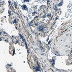 Immunohistochemical staining of human placenta shows moderate cytoplasmic positivity in endothelial cells.