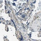 Immunohistochemical staining of human placenta shows moderate cytoplasmic positivity in endothelial cells.